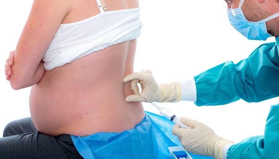 Pregnant woman having an epidural